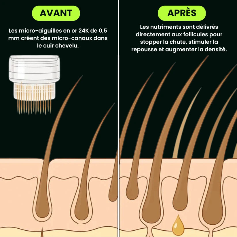 Micro Infusions Liftera – Repousse Active